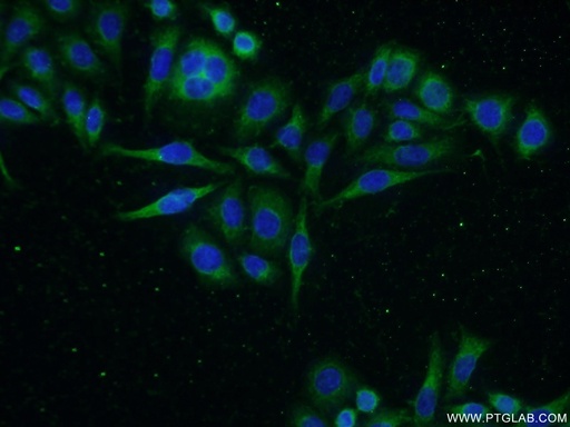 [10449-1-AP-20UL] GADD34 Polyclonal antibody