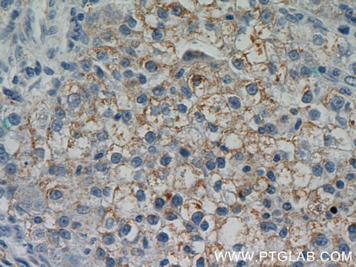 [10452-1-AP-20UL] DSE Polyclonal antibody