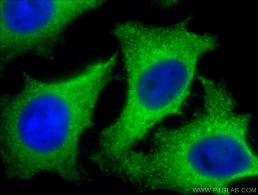 [10455-1-AP-150UL] CLTB Polyclonal antibody