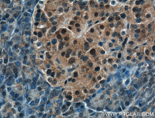 [10464-1-AP-20UL] COPS4 Polyclonal antibody