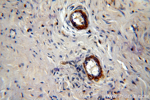 [10465-1-AP-20UL] LAMA4 (Isoform 3) Polyclonal antibody