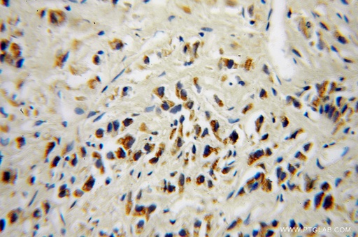 [10481-2-AP-20UL] DOK4 Polyclonal antibody