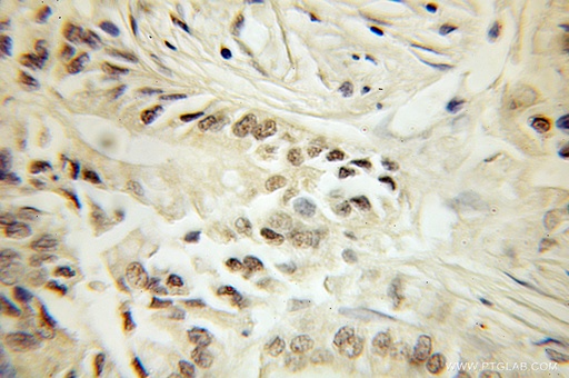 [10482-1-AP-20UL] SF3B4 Polyclonal antibody