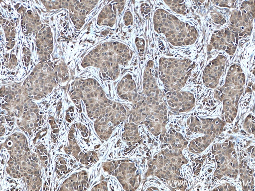 [10484-1-AP-150UL] NUDT2 Polyclonal antibody