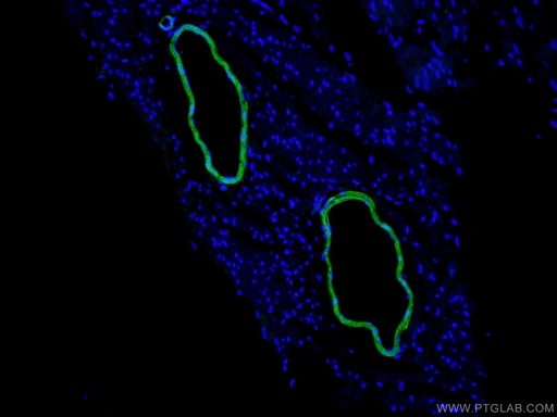 [10493-1-AP-20UL] transgelin/SM22 Polyclonal antibody