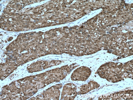 [10500-1-AP-20UL] ASC/TMS1 Polyclonal antibody