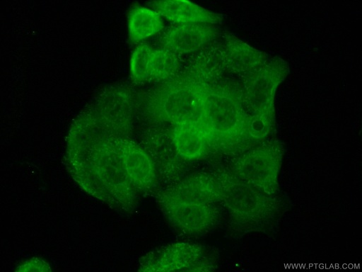 [10501-1-AP-20UL] PSAT1 Polyclonal antibody