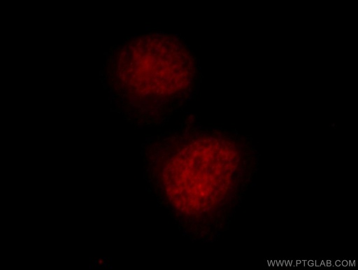 [10502-1-AP-150UL] TCEB3 Polyclonal antibody