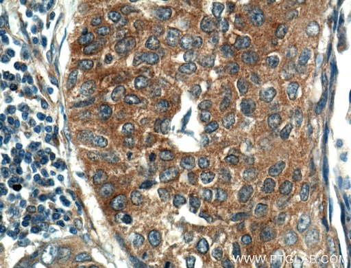 [10503-2-AP-20UL] KEAP1 Polyclonal antibody