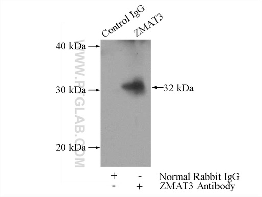 [10504-1-AP-150UL] ZMAT3 Polyclonal antibody