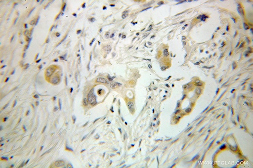 [10505-1-AP-20UL] GSTA2 Polyclonal antibody