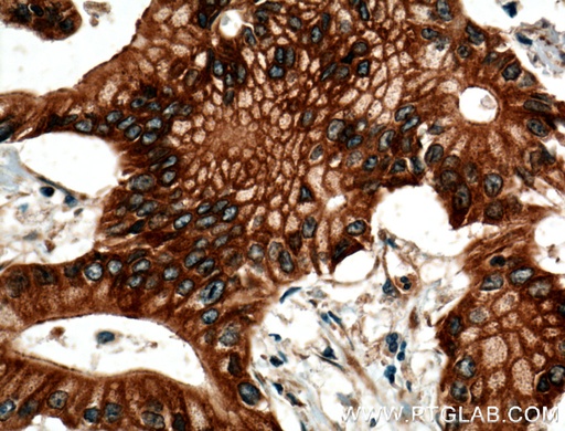 [10510-1-AP-150UL] BLK Polyclonal antibody