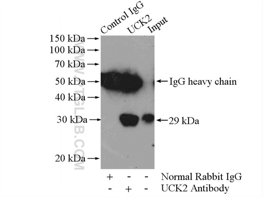 [10511-1-AP-20UL] UCK2 Polyclonal antibody