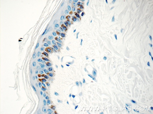 [10514-2-AP-150UL] Kallikrein 5 Polyclonal antibody