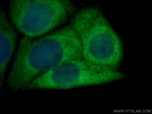 [10527-1-AP-20UL] NRG1 Polyclonal antibody