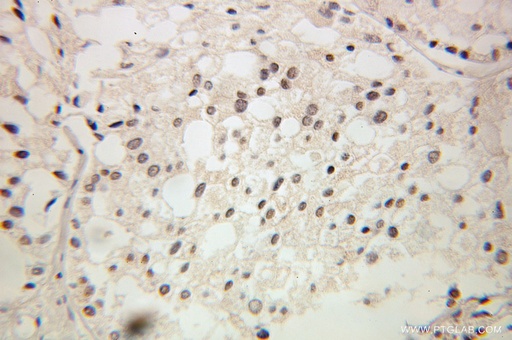 [10540-1-AP-150UL] GTF2A2 Polyclonal antibody