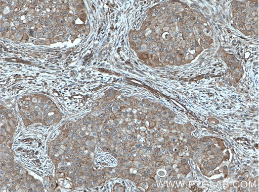 [10541-1-AP-20UL] Calmodulin Polyclonal antibody