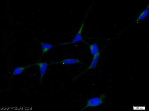 [10542-1-AP-20UL] RABAC1 Polyclonal antibody