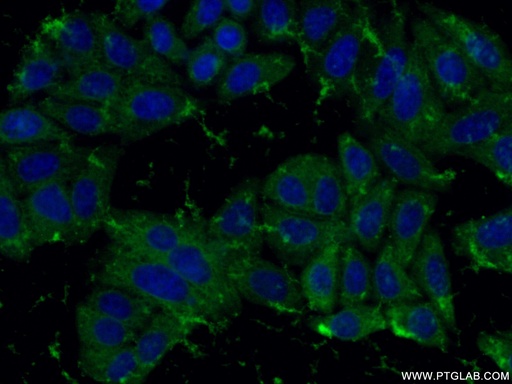 [10545-2-AP-20UL] peroxiredoxin 2 Polyclonal antibody