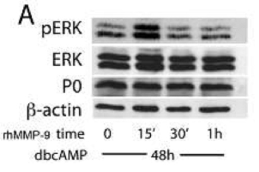 [10572-1-AP-150UL] MPZ / P0 Polyclonal antibody