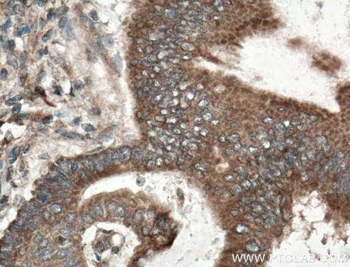 [10575-1-AP-150UL] RKIP Polyclonal antibody