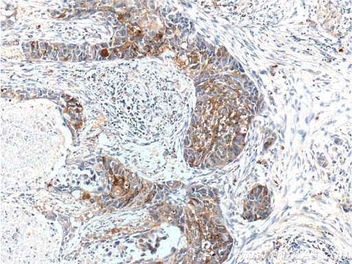 [10576-1-AP-20UL] RPN2 Polyclonal antibody