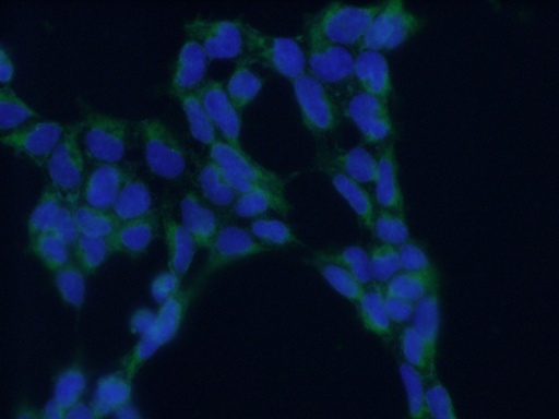 [10583-1-AP-150UL] TRAPA/SSR1 Polyclonal antibody