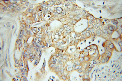 [10584-1-AP-20UL] IA-2/PTPRN Polyclonal antibody