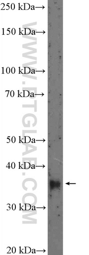 [10592-1-AP-20UL] DLX5 Polyclonal antibody