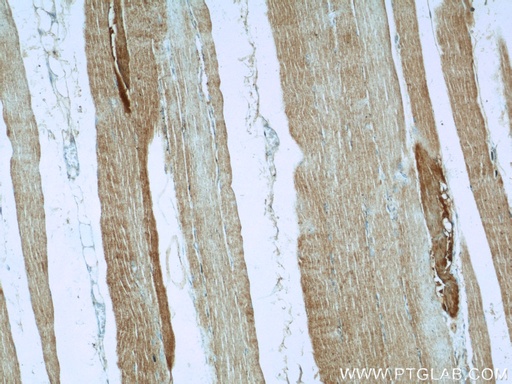 [10601-1-AP-20UL] AGPAT1 Polyclonal antibody
