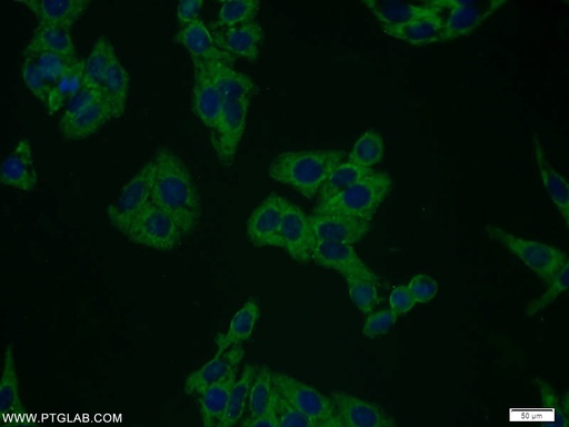 [10602-1-AP-20UL] Plexin B2 Polyclonal antibody