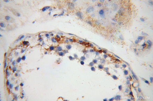 [10604-2-AP-20UL] IFT81 Polyclonal antibody