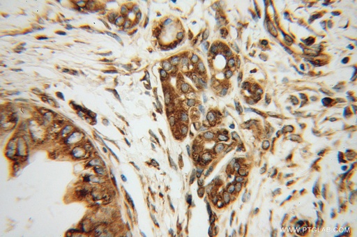 [10630-1-AP-20UL] EEF1D Polyclonal antibody