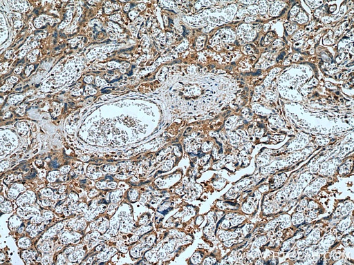 [10642-1-AP-150UL] Placental Growth Factor Polyclonal antibody