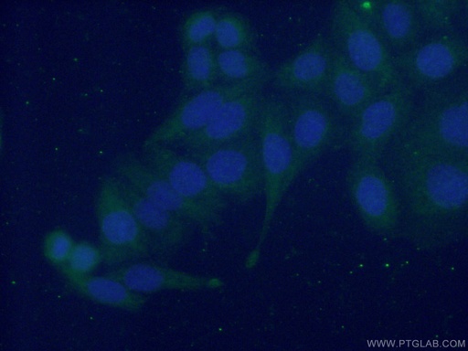 [10643-1-AP-20UL] EMILIN1 Polyclonal antibody