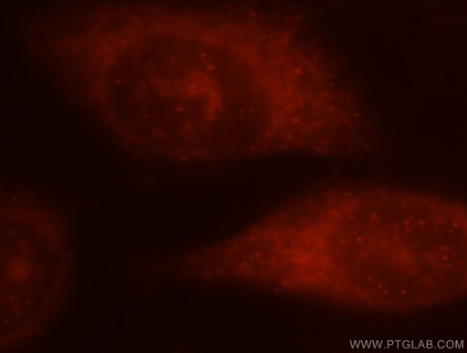 [10021-1-IG-20UL] 5 Lipoxygenase Polyclonal antibody