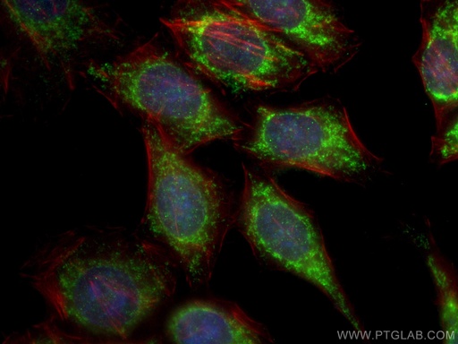 [10022-1-AP-20UL] cIAP1 Polyclonal antibody