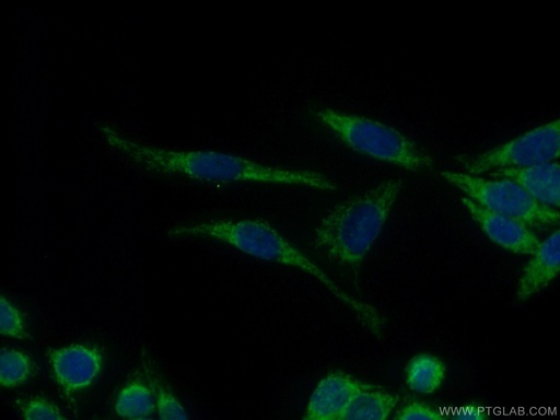 [10023-1-AP-150UL] JNK Polyclonal antibody