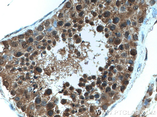 [10060-1-AP-20UL] FKBPL Polyclonal antibody