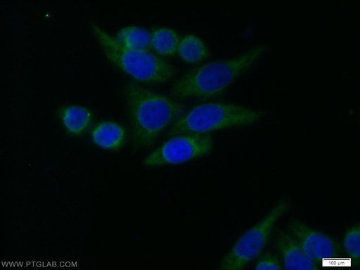 [10069-1-AP-150UL] RB1CC1 Polyclonal antibody