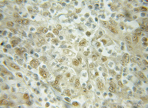 [10077-1-AP-20UL] Importin Beta Polyclonal antibody