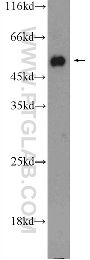 [10086-1-AP-150UL] ACVR1B Polyclonal antibody