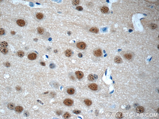 [10089-2-AP-20UL] COPS8/COP9 Polyclonal antibody
