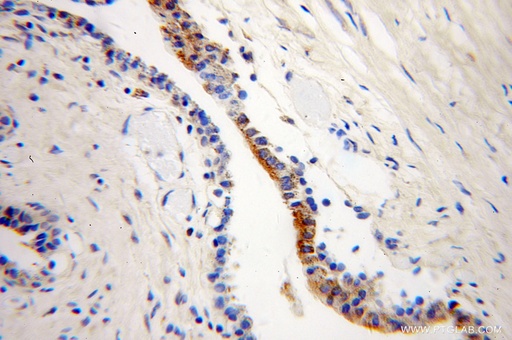 [10090-2-AP-20UL] ARL2BP Polyclonal antibody