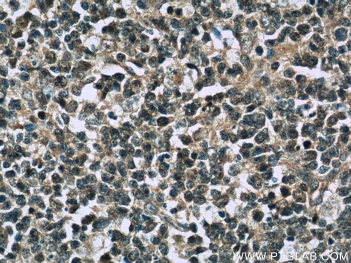 [10097-2-AP-150UL] TFPT Polyclonal antibody