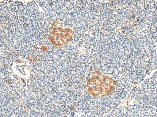 [10102-1-AP-150UL] PCTAIRE1 Polyclonal antibody