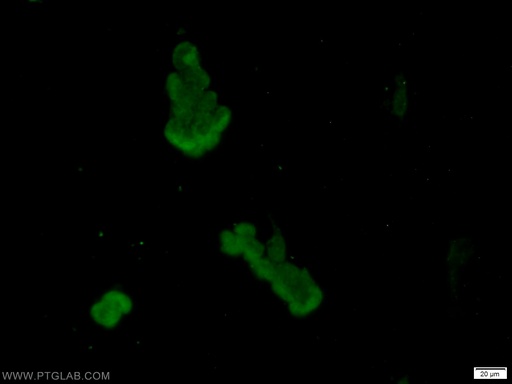 [10103-1-AP-20UL] AKAP8L Polyclonal antibody