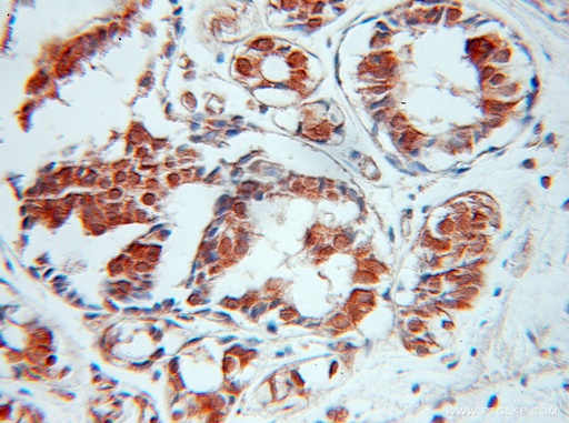 [10107-2-AP-150UL] SPIN2B Polyclonal antibody