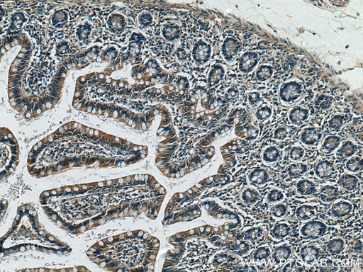 [10108-2-AP-150UL] CX3CL1 Polyclonal antibody