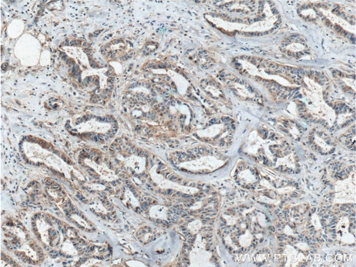 [10121-2-AP-20UL] ICAM2 Polyclonal antibody